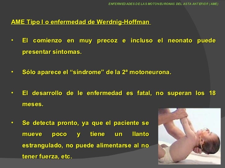 ENFERMEDAD DE WERDNIG HOFFMAN PDF